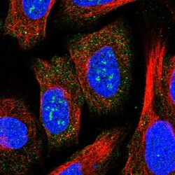 ZCCHC2 Antibody, Novus Biologicals:Antibodies:Primary Antibodies